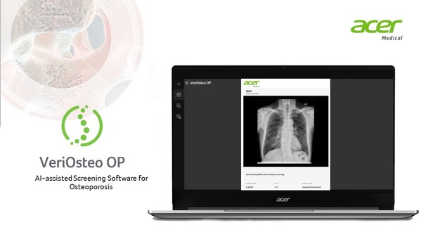 Acer Medical: VeriOsteo OP Obtains Medical Device Approval from Indonesia's Ministry of Health